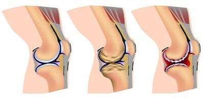 Stages of development of the artery of the knee joint
